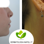 dermatologo-napoli-aversa-laseradioodi