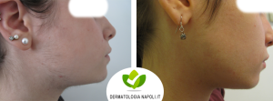 dermatologo-napoli-aversa-laseradioodi