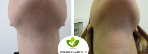 dermatologo-napoli-aversa-laseradioodi